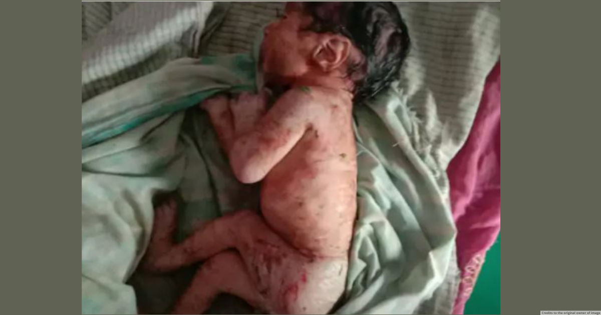 Newborn girl child found dumped in bushes in Churu